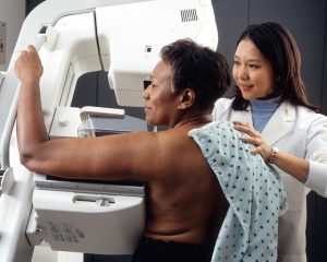 Why Mammograms Every 2 Years: Screening Benefits & Risks