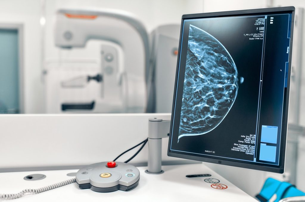 3D Tomographic Mammography Services in the Bay Area | Breast Cancer Screening