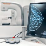 3D Tomographic Mammography Services in the Bay Area | Breast Cancer Screening