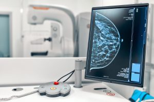 3D Tomographic Mammography Services in the Bay Area | Breast Cancer Screening