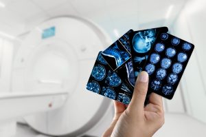 What Happens After Your Scan? A Look Inside the Radiologist’s Report